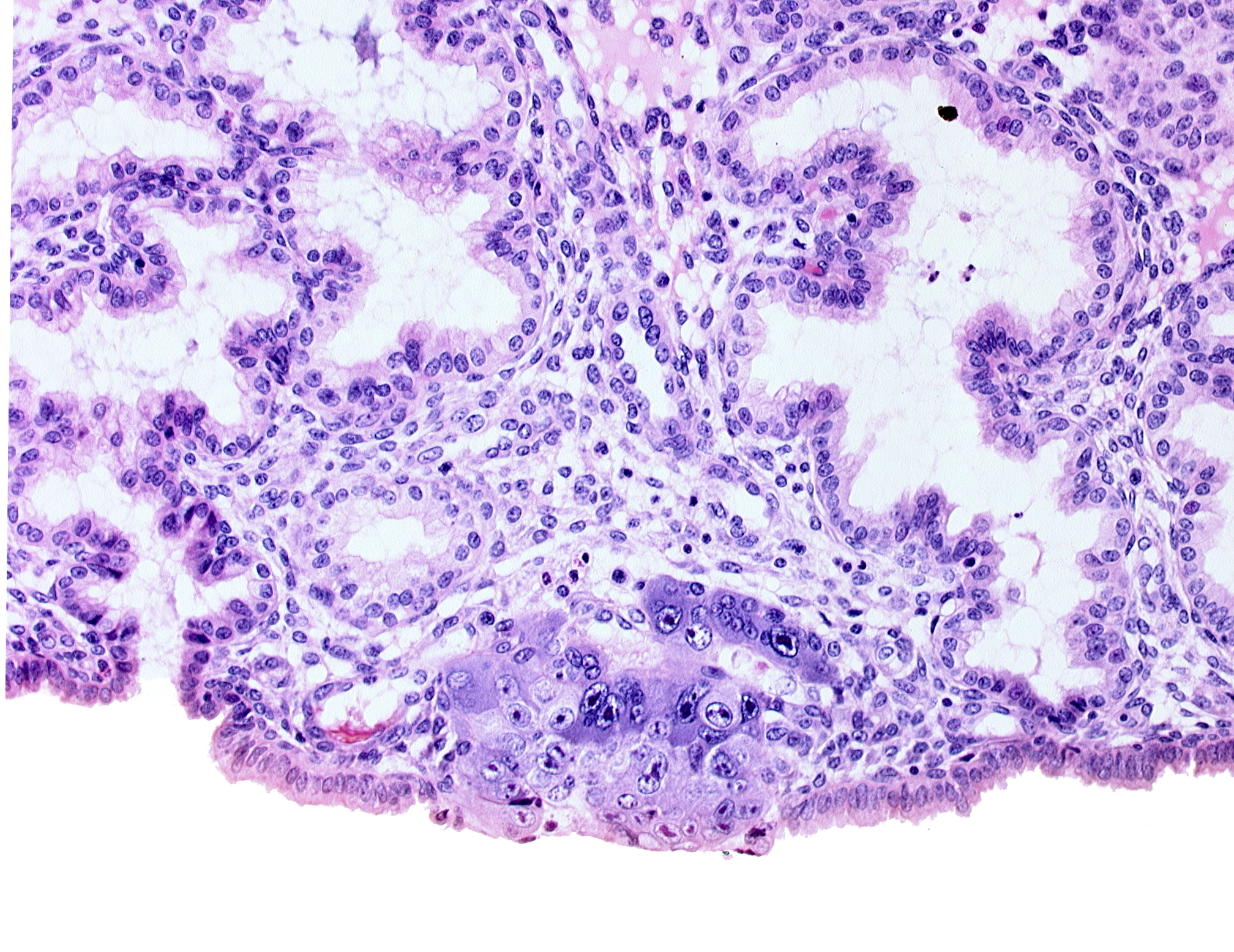 blastocystic cavity (blastocoele), cytotrophoblast, edge of membranous trophoblast at abembryonic pole, endometrial sinusoid, syncytiotrophoblastic mass