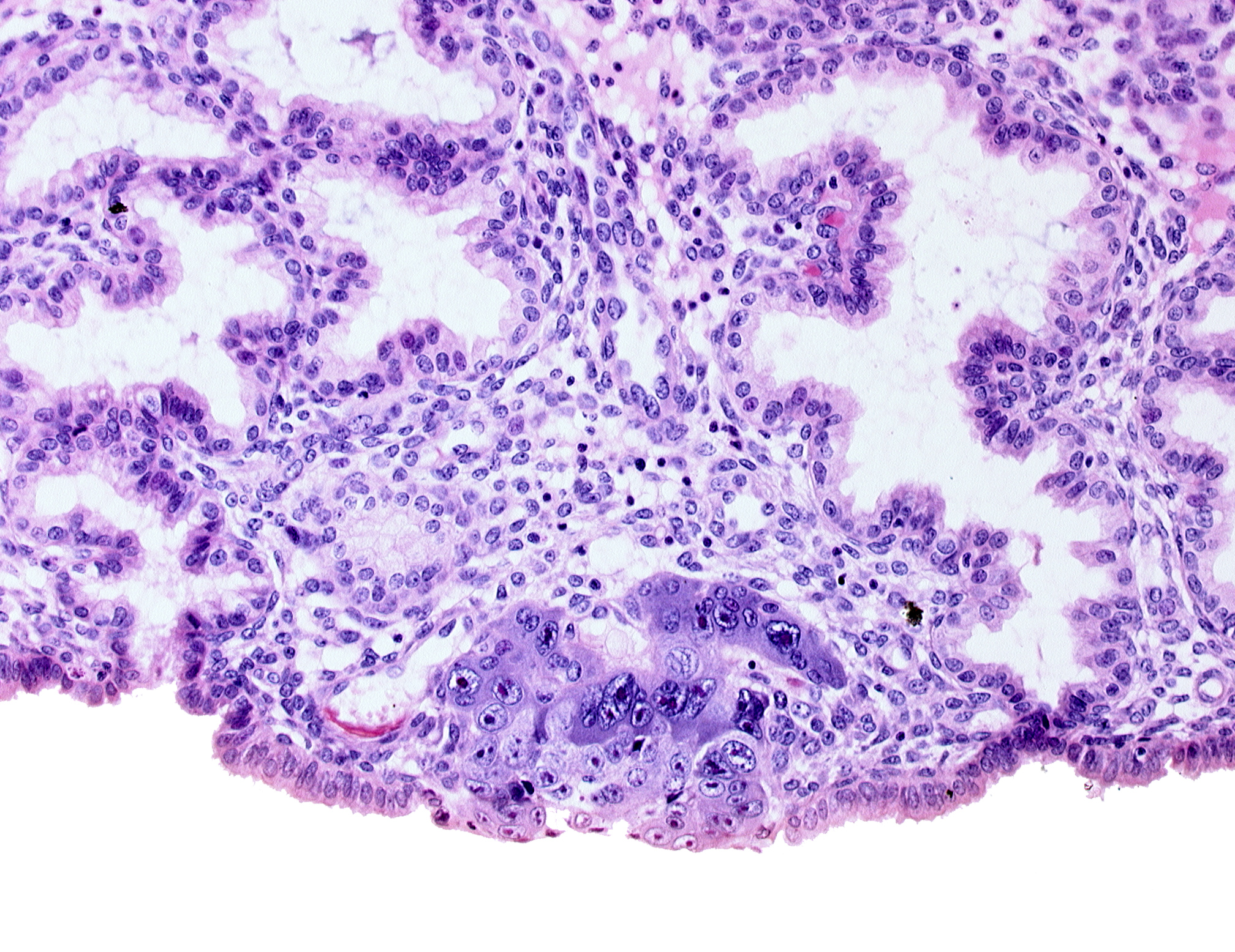 blastocystic cavity (blastocoele), endometrial epithelium, endometrial sinusoid, membranous trophoblast at abembryonic pole, syncytiotrophoblastic mass, uterine cavity