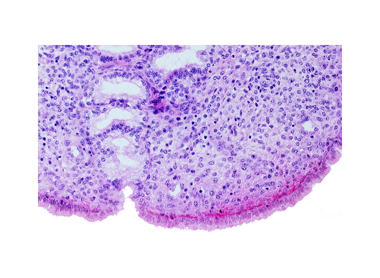 endometrial sinusoid, endometrial stroma (decidua), intact endometrial epithelium, uterine cavity