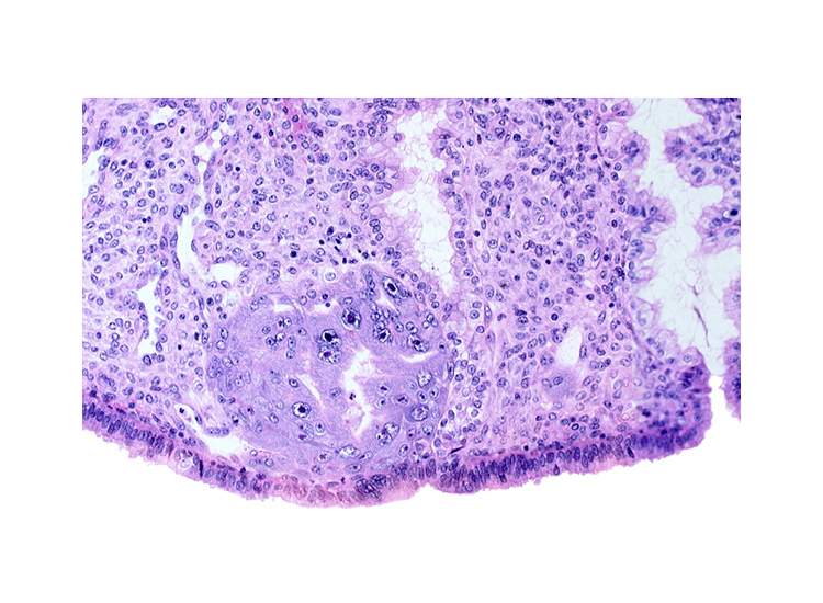 endometrial gland, endometrial sinusoid, intact endometrial epithelium, lumen of endometrial gland, syncytiotrophoblast, trophoblast lacunae