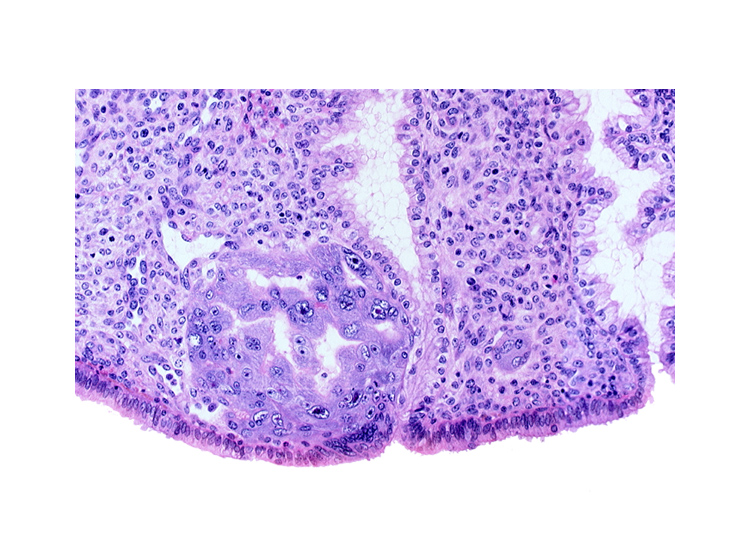 endometrial sinusoid, intact endometrial epithelium, lumen of endometrial gland, syncytiotrophoblast