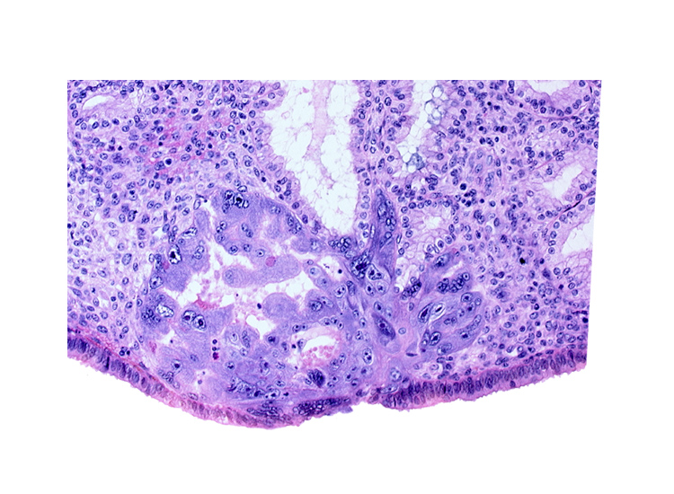 endometrial epithelium, intercommunicating lacunae, lumen of endometrial gland, maternal blood cells in primary umbilical vesicle cavity