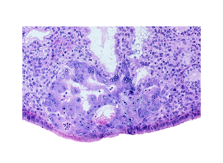 endometrial epithelium, lumen of endometrial gland, primary umbilical vesicle cavity, uterine cavity