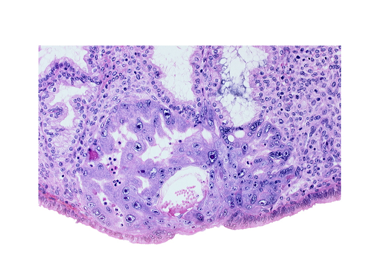 extra-embryonic mesoblast, intercommunicating lacunae, lumen of endometrial gland, maternal blood cells in primary umbilical vesicle cavity