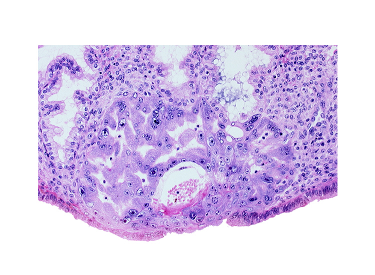 extra-embryonic mesoblast, intact endometrial epithelium, lumen of endometrial gland, maternal blood cells in primary umbilical vesicle cavity, primary umbilical vesicle cavity