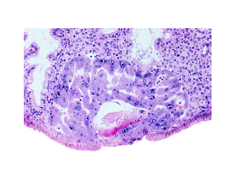 cytotrophoblast, endometrial sinusoid, extra-embryonic mesoblast, intercommunicating lacunae, syncytiotrophoblast