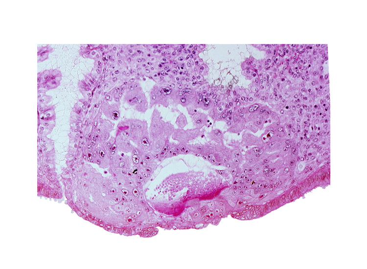 cytotrophoblast, disrupted endometrial epithelium, intercommunicating lacunae, maternal blood cells in primary umbilical vesicle cavity, mouth of endometrial gland, syncytiotrophoblast