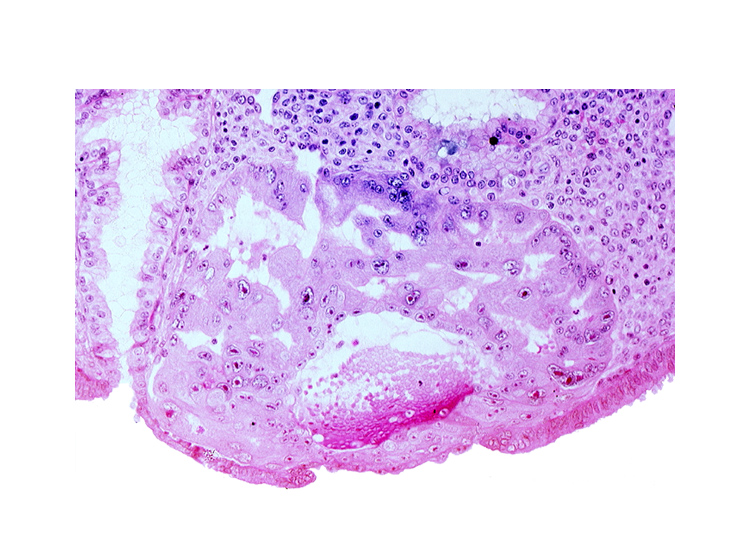 lumen of endometrial gland, maternal blood cells in primary umbilical vesicle cavity, mouth of endometrial gland