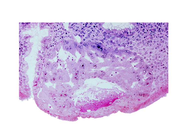 cytotrophoblast, disrupted endometrial epithelium, lumen of endometrial gland, maternal blood cells in primary umbilical vesicle cavity, syncytiotrophoblast