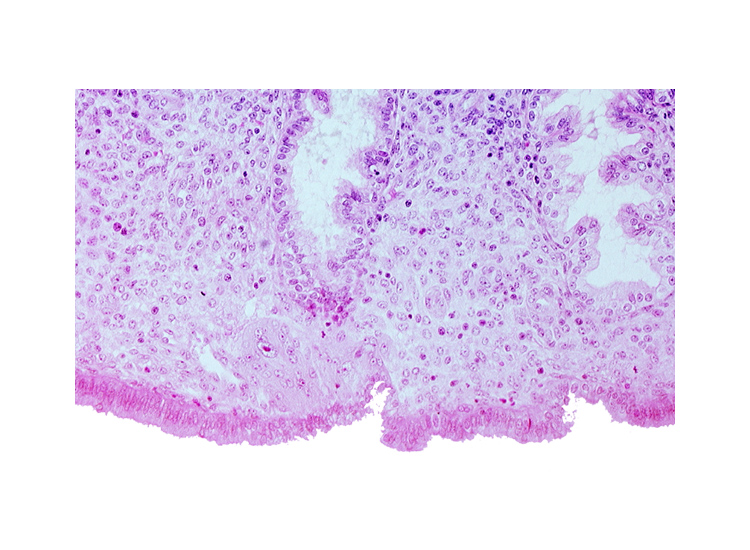 edematous endometrial stroma (decidua), syncytiotrophoblast, uterine cavity