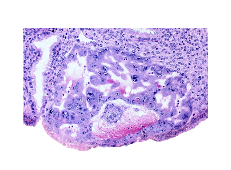 amnioblast(s), cytotrophoblast, disrupted endometrial epithelium, endometrial epithelium, epiblast, extra-embryonic endoblast, hypoblast, primary umbilical vesicle cavity, syncytiotrophoblast