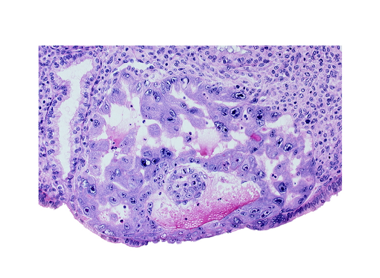 endometrial sinusoid, intercommunicating lacunae, lumen of endometrial gland