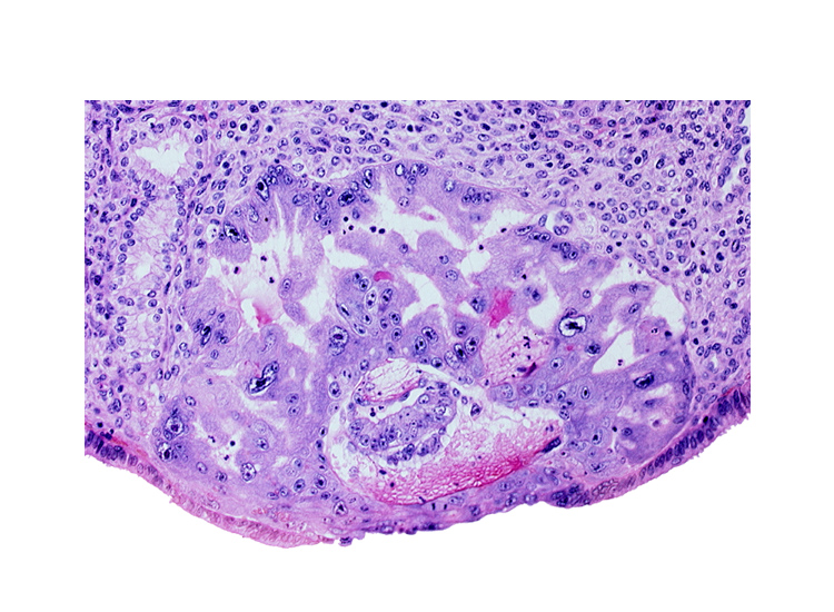 amniotic cavity, epiblast, hypoblast, maternal blood cells in primary umbilical vesicle cavity