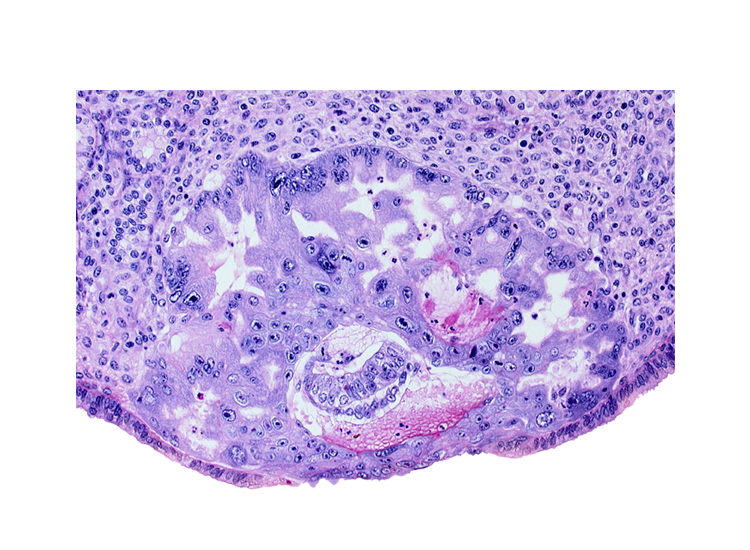 amnioblast(s), amniotic cavity, cytotrophoblast, epiblast, extra-embryonic endoblast, hypoblast, maternal blood cells in primary umbilical vesicle cavity, syncytiotrophoblast