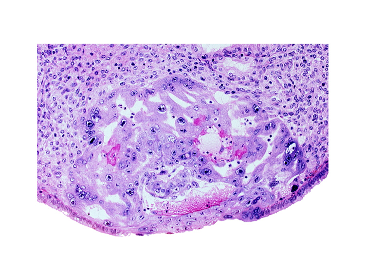 amnioblast(s), embryonic disc, endometrial epithelium, uterine cavity