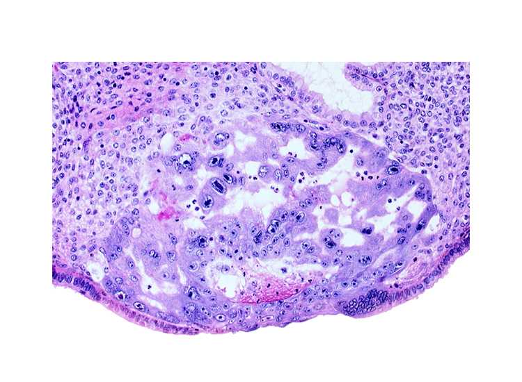 maternal blood cells in primary umbilical vesicle cavity, primary umbilical vesicle cavity