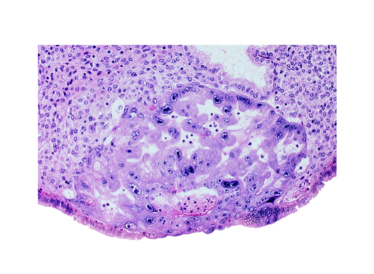 endometrial epithelium, endometrial sinusoid, primary umbilical vesicle cavity, uterine cavity