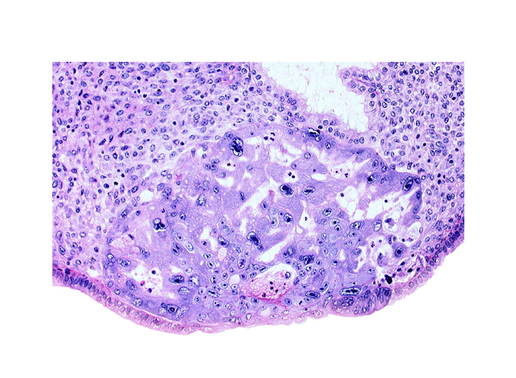 intercommunicating lacunae, uterine cavity