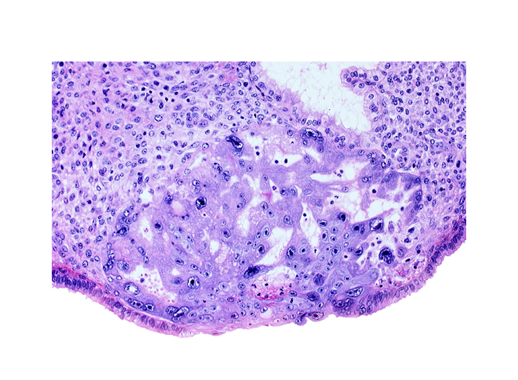 cytotrophoblast, edge of primary umbilical vesicle cavity, intercommunicating lacunae, syncytiotrophoblast, uterine cavity