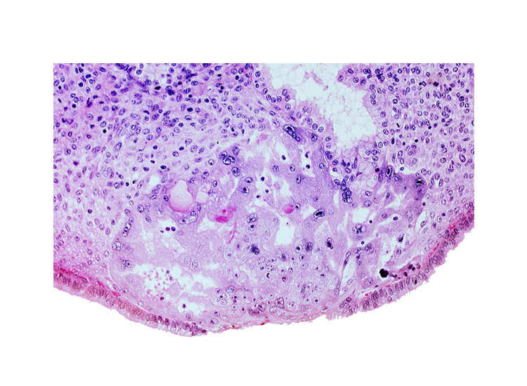 degenerated endodermal epithelium, intercommunicating lacunae, lumen of endometrial gland, uterine cavity