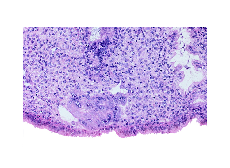 endometrial gland, endometrial sinusoid, intact endometrial epithelium, syncytiotrophoblast, uterine cavity