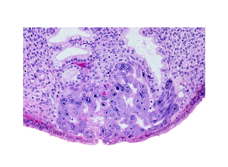 endometrial gland, endometrial sinusoid, intercommunicating lacunae, lumen of endometrial gland, uterine cavity