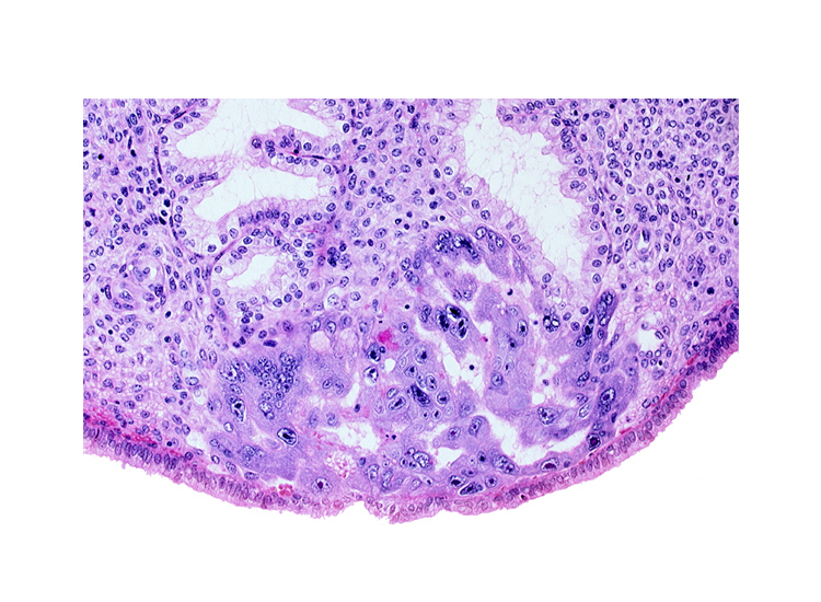 endometrial sinusoid, intercommunicating lacunae, lumen of endometrial gland, syncytiotrophoblast, uterine cavity