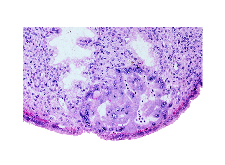 endometrial sinusoid, intact endometrial epithelium, lumen of endometrial gland, maternal blood cells in intercommunicating lacunae, uterine cavity