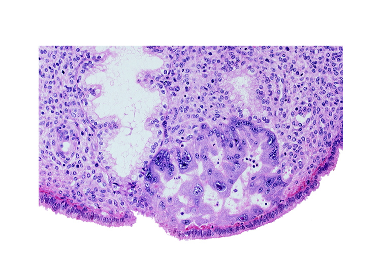 endometrial epithelium, endometrial sinusoid, maternal blood cells in intercommunicating lacunae