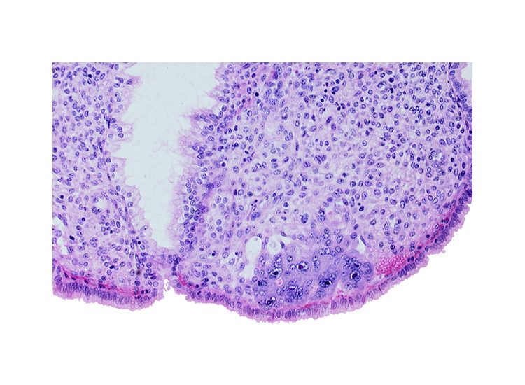 endometrial stroma (decidua), lumen of endometrial gland, syncytiotrophoblast, uterine cavity