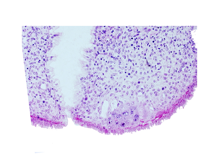 mouth of endometrial gland, syncytiotrophoblast