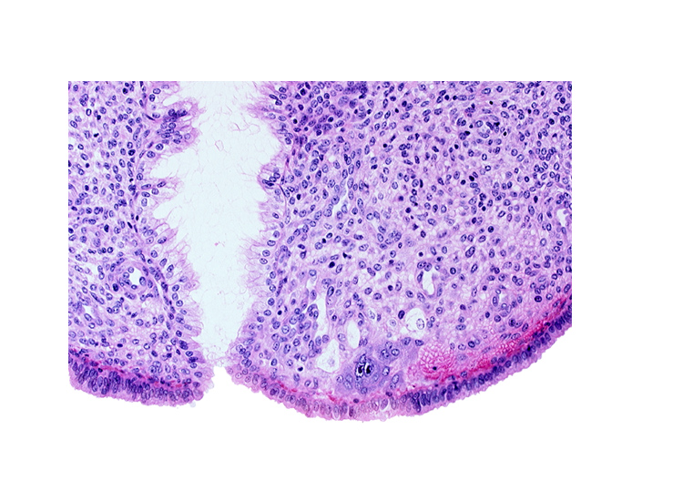 endometrial sinusoid, endometrial stroma (decidua), intact endometrial epithelium, mouth of endometrial gland, syncytiotrophoblast