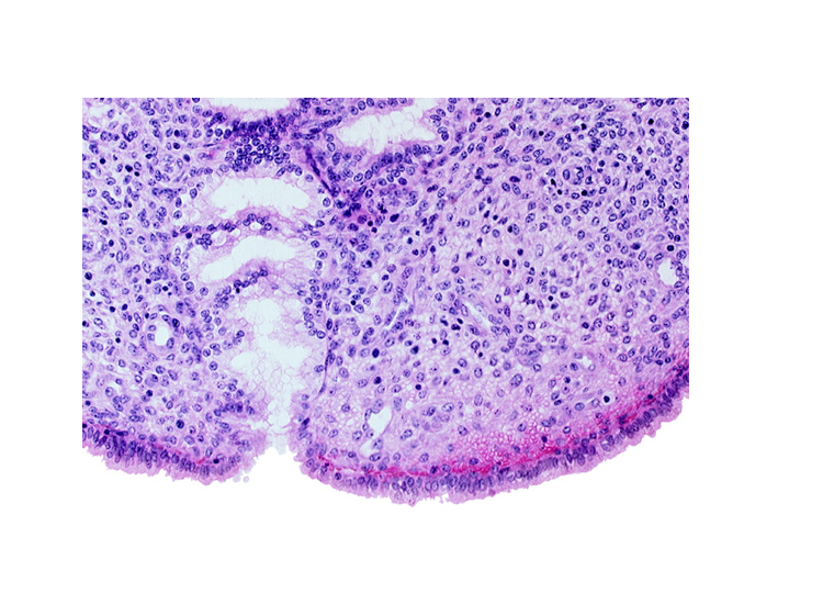 endometrial sinusoid, mouth of endometrial gland