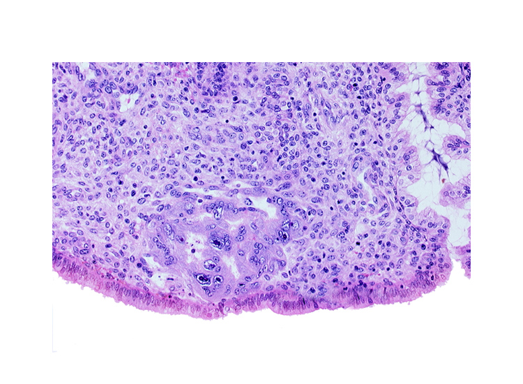 edematous endometrial stroma (decidua), endometrial sinusoid, intact endometrial epithelium, syncytiotrophoblast, trophoblast lacunae