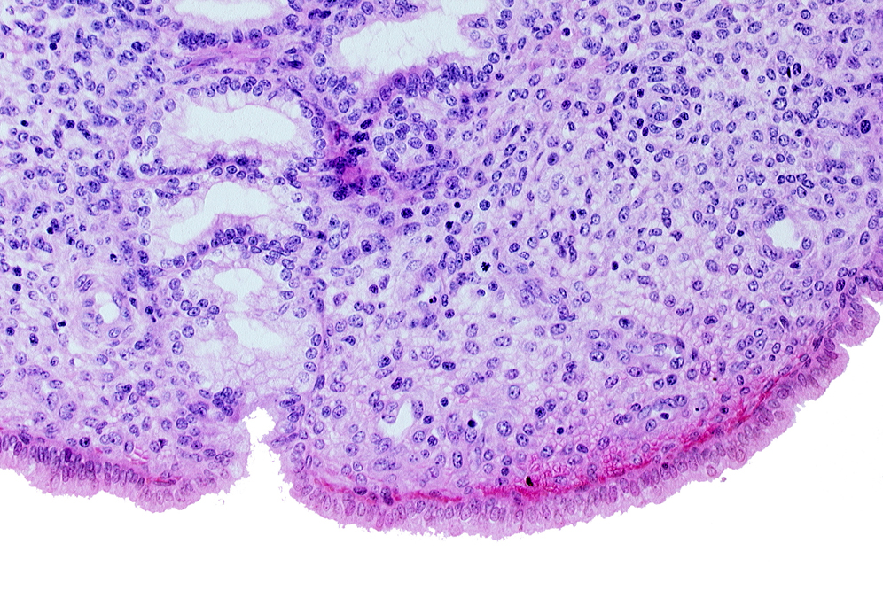 endometrial sinusoid, endometrial stroma (decidua), intact endometrial epithelium, uterine cavity