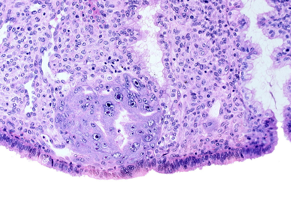 endometrial gland, endometrial sinusoid, intact endometrial epithelium, lumen of endometrial gland, syncytiotrophoblast, trophoblast lacunae