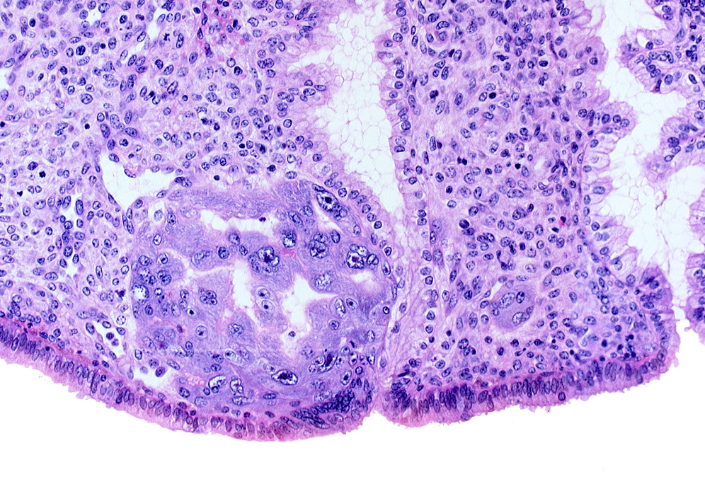 endometrial sinusoid, intact endometrial epithelium, lumen of endometrial gland, syncytiotrophoblast