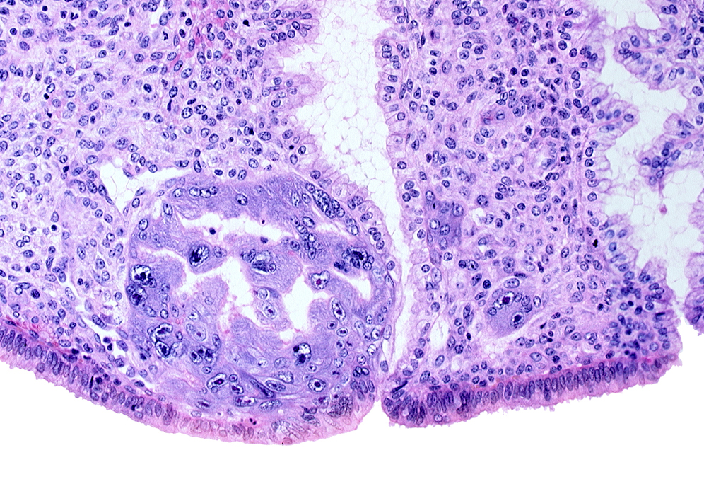 endometrial sinusoid, intact endometrial epithelium, intercommunicating lacunae, lumen of endometrial gland, mouth of endometrial gland, syncytiotrophoblast