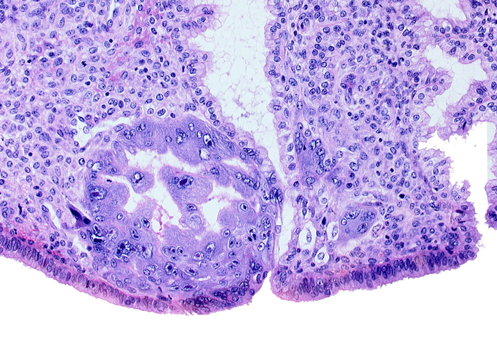 endometrial epithelium, syncytiotrophoblast, uterine cavity