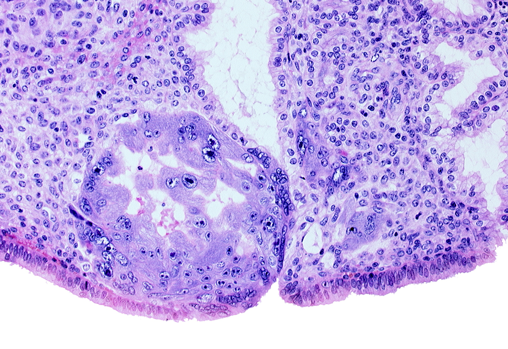 edematous endometrial stroma (decidua), edge of primary umbilical vesicle cavity, intact endometrial epithelium, intercommunicating lacunae, lumen of endometrial gland, mouth of endometrial gland, syncytiotrophoblast, uterine cavity