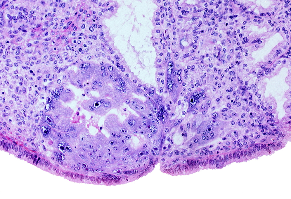 chorionic cavity, endometrial epithelium, lumen of endometrial gland, syncytiotrophoblast