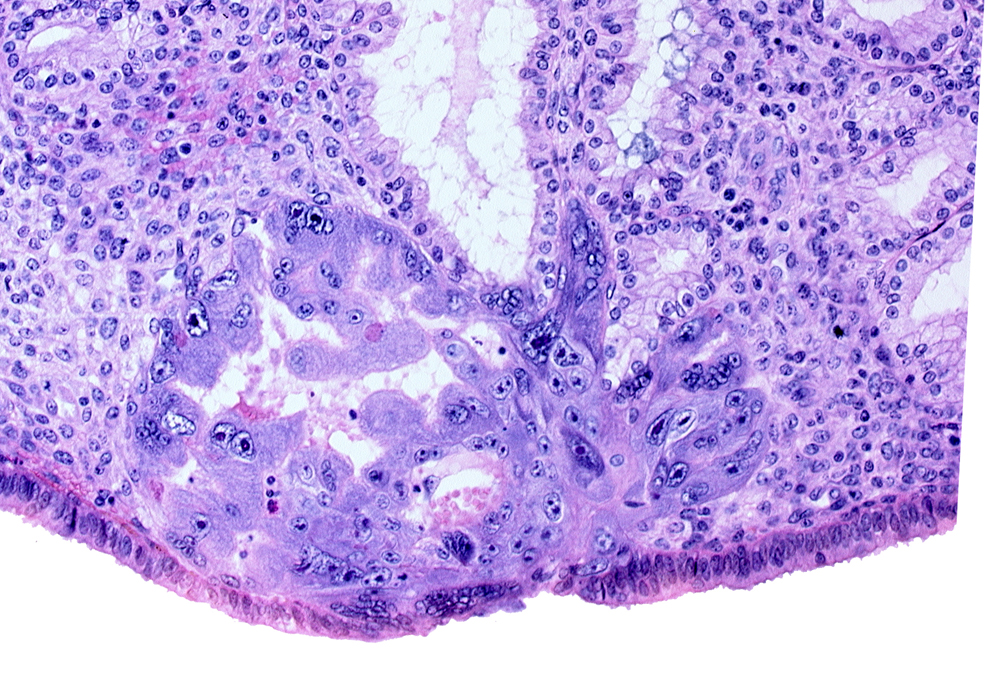 endometrial epithelium, intercommunicating lacunae, lumen of endometrial gland, maternal blood cells in primary umbilical vesicle cavity