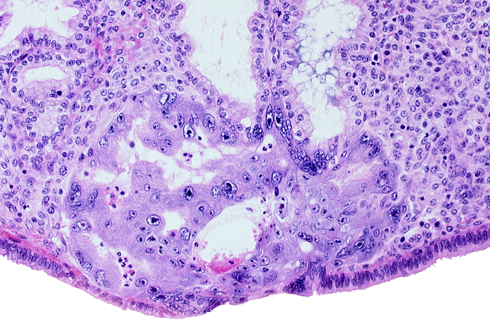 endometrial sinusoid, intercommunicating lacunae, primary umbilical vesicle cavity