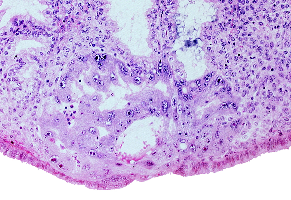 cytotrophoblast, endometrial sinusoid, endometrial stroma (decidua), intercommunicating lacunae, primary umbilical vesicle cavity, syncytiotrophoblast