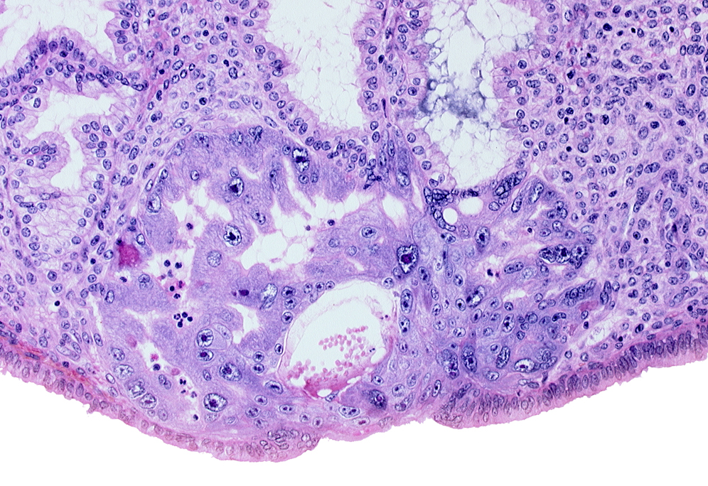 extra-embryonic mesoblast, intercommunicating lacunae, lumen of endometrial gland, maternal blood cells in primary umbilical vesicle cavity