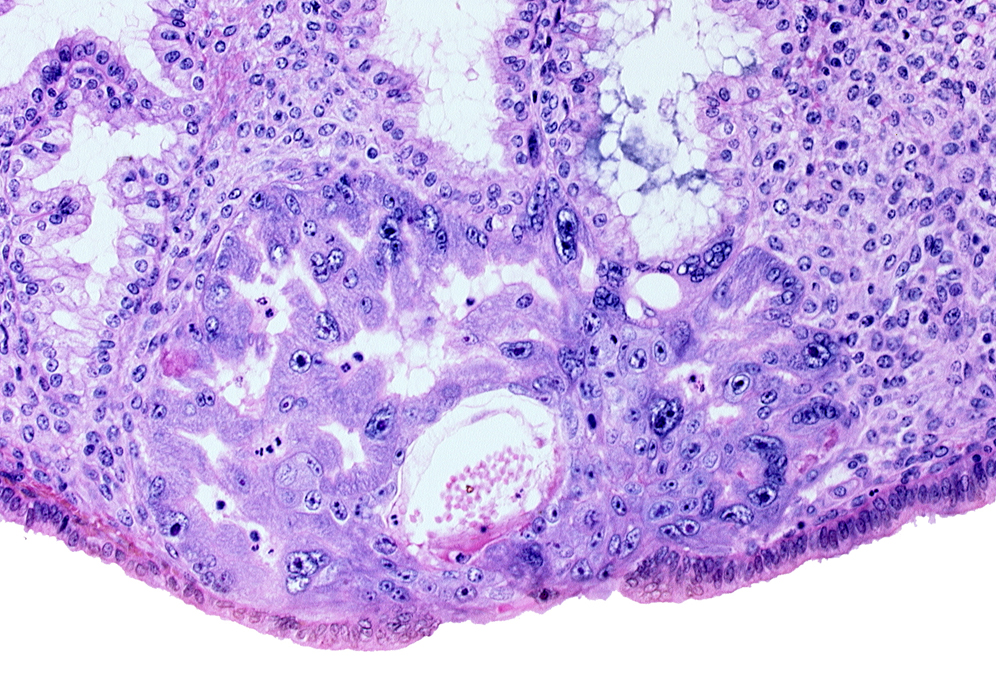 cytotrophoblast, extra-embryonic mesoblast, intercommunicating lacunae, maternal blood cells in primary umbilical vesicle cavity, syncytiotrophoblast