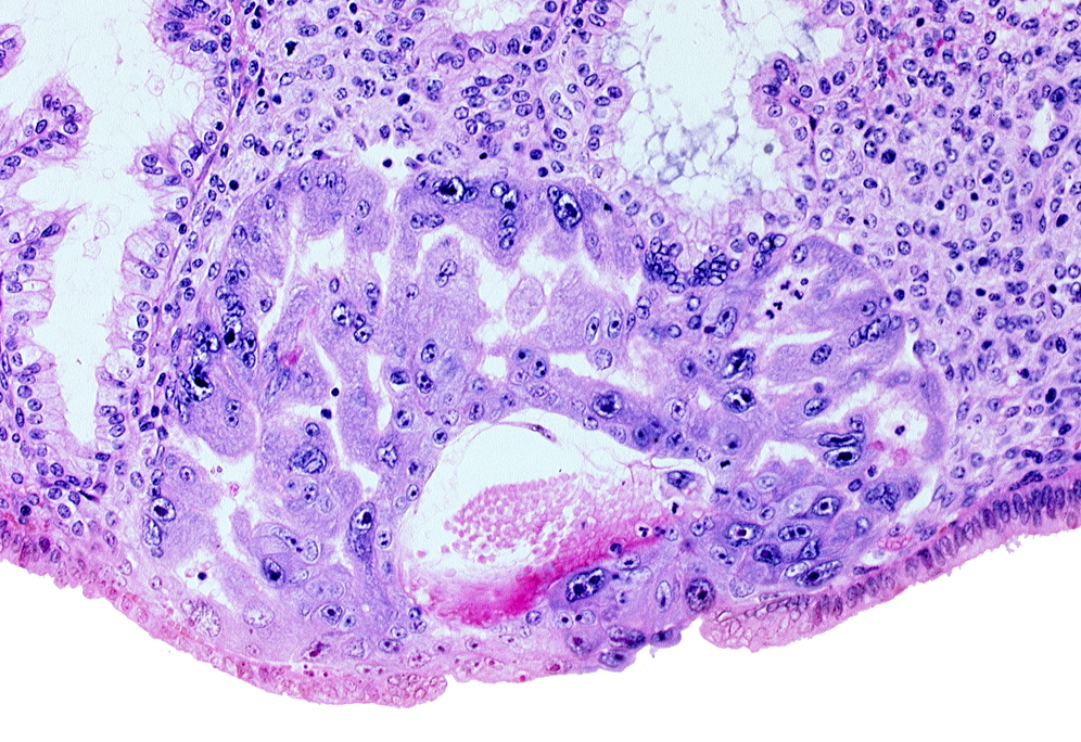 cytotrophoblast, endometrial sinusoid, extra-embryonic mesoblast, intercommunicating lacunae, syncytiotrophoblast