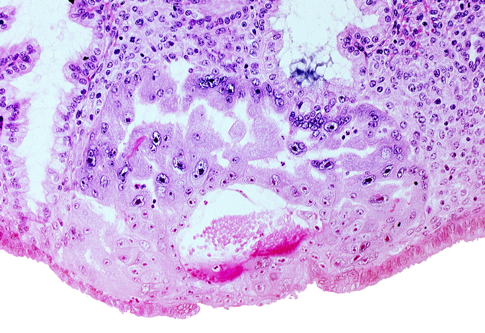 extra-embryonic mesoblast, intercommunicating lacunae, maternal blood cells in primary umbilical vesicle cavity, syncytiotrophoblast