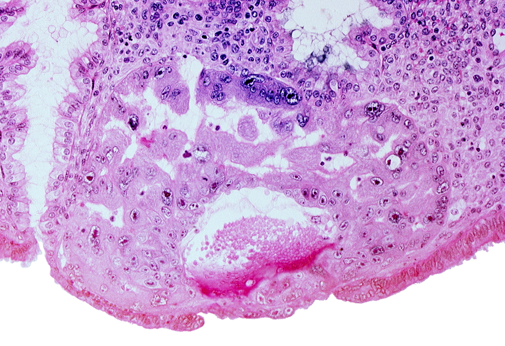 endometrial sinusoid, lumen of endometrial gland, maternal blood cells in primary umbilical vesicle cavity, mouth of endometrial gland