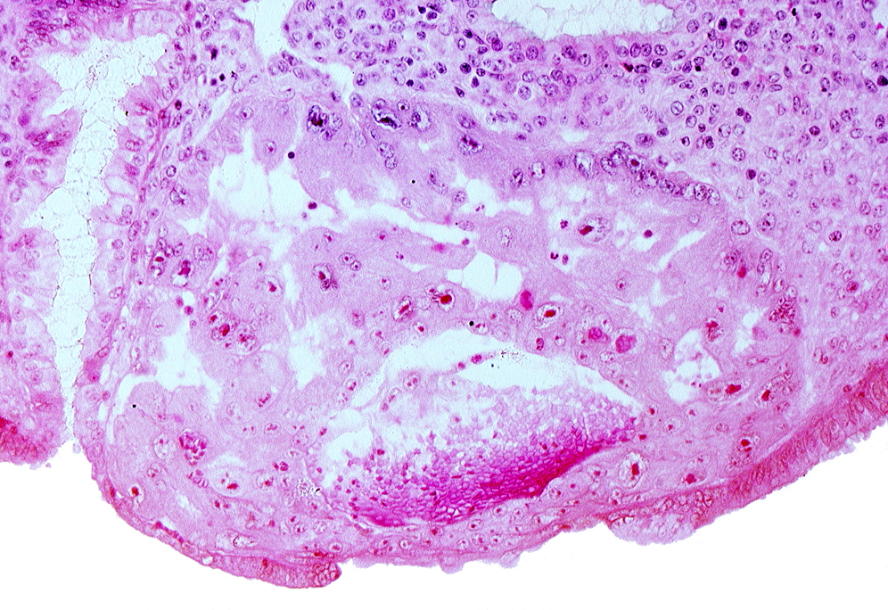 cytotrophoblast, disrupted endometrial epithelium, edge of embryonic disc, extra-embryonic endoblast, intact endometrial epithelium, intercommunicating lacunae, syncytiotrophoblast